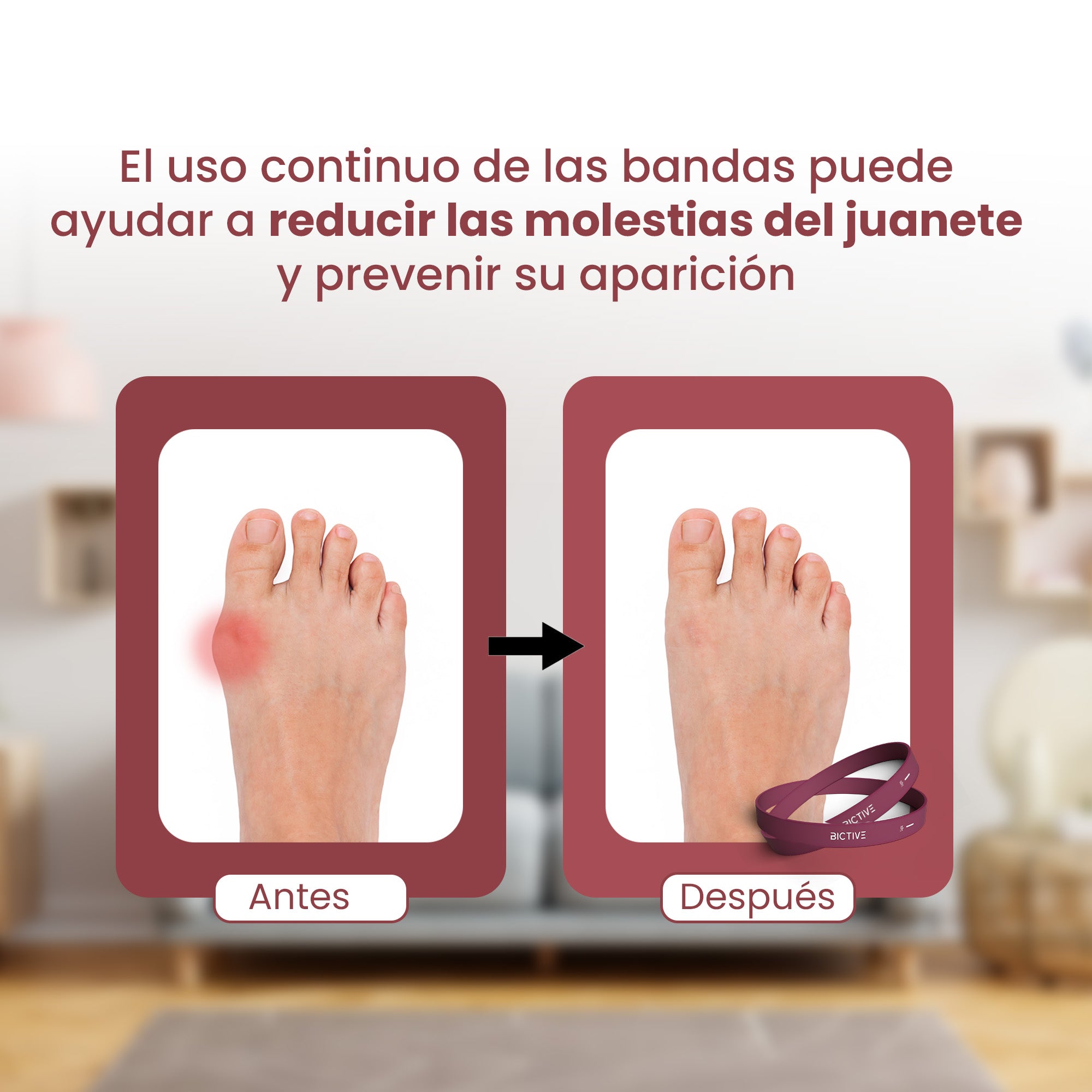 Bandas Elásticas para Entrenar y Reducir las molestias de Juanetes